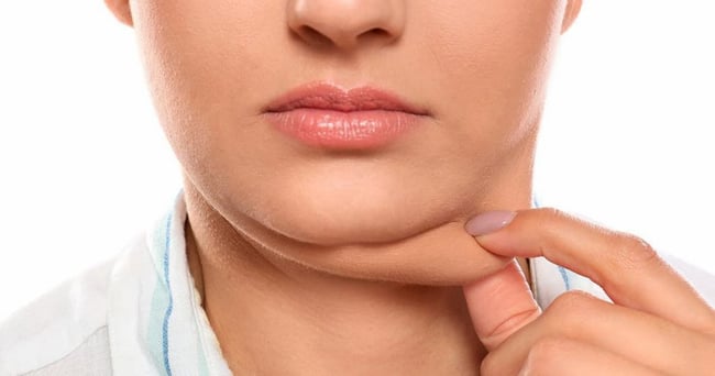 Gordura Localizada Facial - Lumevié